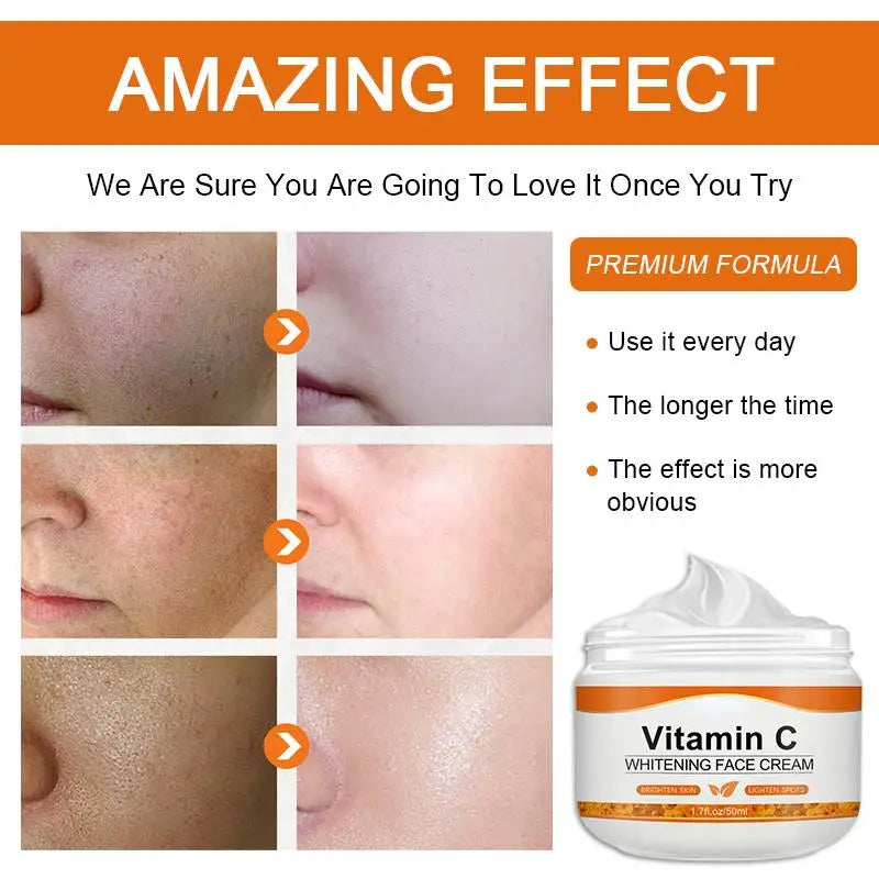 Cardie B Vitamin C Face Cream Remove Dark